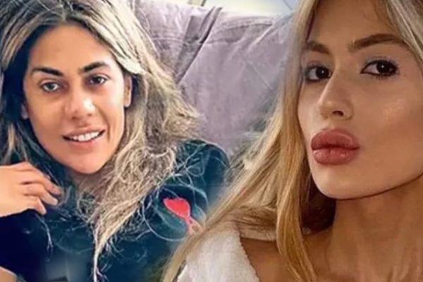 Cezaevinden 37 Kilo ile Çıkmıştı: Nihal Candan’ın Son Hali Sosyal Medyada Olay Oldu